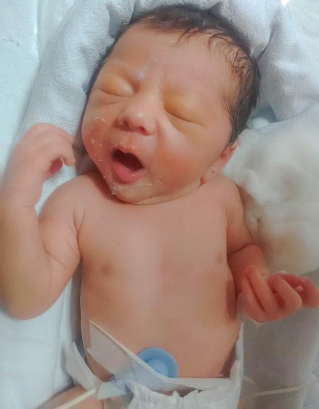 Early Cue - Mouth Movements